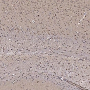 IHC staining of FFPE rat brain tissue with NOB1 antibody. HIER: boil tissue sections in pH8 EDTA for 20 min and allow to cool before testing.