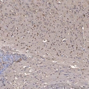 IHC staining of FFPE mouse brain tissue with NOB1 antibody. HIER: boil tissue sections in pH8 EDTA for 20 min and allow to cool before testing.