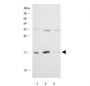 Western blot testing of human 1) HeLa, 2) RT4 and 3) HaCaT cell lysate with SNCG antibody. Expected molecular weight: 13-17 kDa.