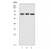 Western blot testing of human 1) A549, 2) HT1080 and 3) MCF7 cell lysate with FERMT2 antibody. Predicted molecular weight ~70 kDa.