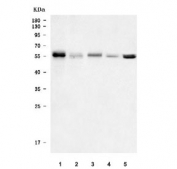 Western blot testing of 1) human Daudi, 2) human MOLT4, 3) rat spleen, 4) mouse spleen and 5) mouse NIH 3T3 cell lysate with WIPF1 antibody. Commonly observed molecular weight: 50-55 kDa with a possible ~36 kDa isoform.