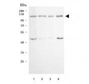 Western blot testing of human 1) Hela, 2) MCF7, 3) T-47D and 4) PC-3 cell lysate with SCYL1 antibody. Predicted molecular weight ~90 kDa, commonly observed at 90-115 kDa.