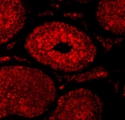 Immunofluorescent staining of FFPE rat testis tissue with SAE1 antibody. HIER: steam section in pH8 EDTA buffer for 20 min.