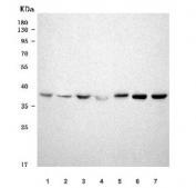 Western blot testing of 1) human HeLa, 2) human Jurkat, 3) human 293T, 4) human MCF7, 5) rat testis, 6) mouse testis and 7) mouse thymus tissue lysate with SAE1 antibody. Predicted molecular weight ~38 kDa.