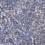 IHC staining of FFPE human duodenum tissue with SAE1 antibody. HIER: boil tissue sections in pH8 EDTA for 20 min and allow to cool before testing.
