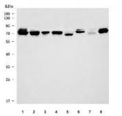 Western blot testing of 1) human HeLa, 2) human 293T, 3) human placenta, 4) human Jurkat, 5) rat kidney, 6) rat PC-12, 7) mouse kidney and 8) mouse NIH 3T3 cell lysate with TBX18 antibody. Predicted molecular weight ~64 kDa, commonly observed at 64-70 kDa.
