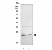 Western blot testing of human 1) U-87 MG and 2) HeLa cell lysate with SEC22B antibody. Predicted molecular weight ~25 kDa.
