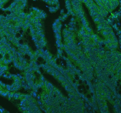 Immunofluorescent staining of FFPE human colon cancer tissue with SEC22B antibody (green) and DAPI nuclear stain (blue). HIER: steam section in pH8 EDTA buffer for 20 min.