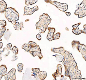 IHC staining of FFPE human placental tissue with SEC22B antibody. HIER: boil tissue sections in pH8 EDTA for 20 min and allow to cool before testing.
