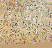 IHC staining of FFPE mouse brain tissue with SEC22B antibody. HIER: boil tissue sections in pH8 EDTA for 20 min and allow to cool before testing.