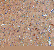 IHC staining of FFPE rat brain tissue with SEC22B antibody. HIER: boil tissue sections in pH8 EDTA for 20 min and allow to cool before testing.