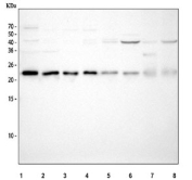 Western blot testing of 1) human U-87 MG, 2) human HeLa, 3) human MCF7, 4) human SH-SY5Y, 5) rat brain, 6) rat liver, 7) mouse brain and 8) mouse liver tissue lysate with SEC22B antibody. Predicted molecular weight ~25 kDa.