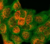 Immunofluorescent staining of FFPE human MCF7 cells with SAP18 antibody (red) and Alpha Tubulin mAb (green). HIER: steam section in pH6 citrate buffer for 20 min.