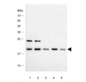 Western blot testing of 1) human HeLa, 2) human K562, 3) human Jurkat, 4) rat RH35 and 5) mouse NIH 3T3 cell lysate with SAP18 antibody. Predicted molecular weight ~18 kDa.