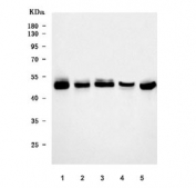 Western blot testing of 1) human Caco-2, 2) human Jurkat, 3) human HeLa, 4) rat pancreas and 5) mouse pancreas tissue lysate with UBA5 antibody. Predicted molecular weight ~45 kDa, commonly observed at 40-50 kDa.