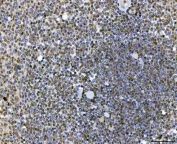 IHC staining of FFPE human spleen tissue with SAP130 antibody. HIER: boil tissue sections in pH8 EDTA for 20 min and allow to cool before testing.