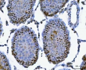 IHC staining of FFPE rat testis tissue with SAP130 antibody. HIER: boil tissue sections in pH8 EDTA for 20 min and allow to cool before testing.