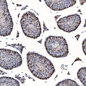 IHC staining of FFPE mouse testis tissue with SAP130 antibody. HIER: boil tissue sections in pH8 EDTA for 20 min and allow to cool before testing.