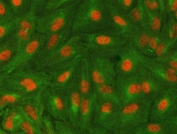 Immunofluorescent staining of FFPE human A549 cells with SAP130 antibody (red) and Alpha Tubulin mAb (green). HIER: steam section in pH6 citrate buffer for 20 min.