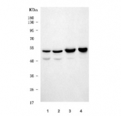 Western blot testing of 1) human Daudi, 2) human U-251, 3) rat brain and 4) mouse brain tissue lysate with TRAIP antibody. Predicted molecular weight ~53 kDa.
