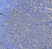 IHC staining of FFPE human tonsil tissue with SAMSN1 antibody. HIER: boil tissue sections in pH8 EDTA for 20 min and allow to cool before testing.