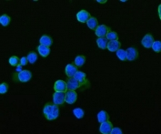 Immunofluorescent staining of FFPE human HEL cells with SAMSN1 antibody (green) and DAPI nuclear stain (blue). HIER: steam section in pH6 citrate buffer for 20 min.
