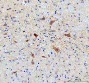 IHC staining of FFPE rat brain tissue with SAMSN1 antibody. HIER: boil tissue sections in pH8 EDTA for 20 min and allow to cool before testing.