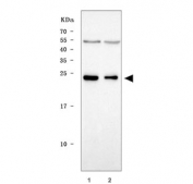 Western blot testing of human 1) MOLT4 and 2) U937 cell lysate with NARF antibody. Predicted molecular weight ~28 kDa.