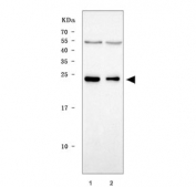 Western blot testing of human 1) MOLT4 and 2) U937 cell lysate with NARF antibody. Predicted molecular weight ~28 kDa.