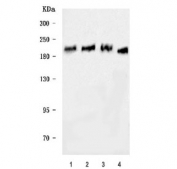 Western blot testing of 1) human 293T, 2) human HeLa, 3) human Jurkat and 4) rat testis tissue lysate with UBE2O antibody. Predicted molecular weight ~141 kDa but commonly observed at up to ~230 kDa.