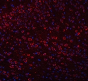 Immunofluorescent staining of FFPE mouse brain tissue with TRANK1 antibody (red) and DAPI nuclear stain (blue). HIER: steam section in pH8 EDTA buffer for 20 min.