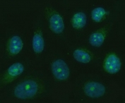 Immunofluorescent staining of FFPE human PC-3 cells with TRANK1 antibody (green) and DAPI nuclear stain (blue). HIER: steam section in pH6 citrate buffer for 20 min.