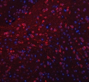 Immunofluorescent staining of FFPE rat brain tissue with TRANK1 antibody (red) and DAPI nuclear stain (blue). HIER: steam section in pH8 EDTA buffer for 20 min.