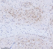 IHC staining of FFPE rat brain tissue with TRANK1 antibody. HIER: boil tissue sections in pH8 EDTA for 20 min and allow to cool before testing.