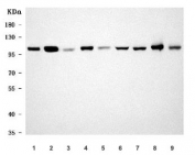 Western blot testing of 1) human HCCT, 2) human HCCP, 3) rat pancreas, 4) rat liver, 5) rat kidney, 6) rat RH35, 7) mouse pancreas, 8) mouse liver and 9) mouse kidney tissue lysate with Sarcosine dehydrogenase antibody. Predicted molecular weight ~101 kDa.