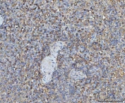 IHC staining of FFPE human spleen tissue with TRMT61B antibody. HIER: boil tissue sections in pH8 EDTA for 20 min and allow to cool before testing.