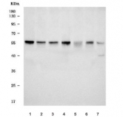 Western blot testing of human 1) HepG2, 2) HeLa, 3) A549, 4) PC-3, 5) Daudi, 6) SH-SY5Y and 7) A431 cell lysate with TRMT61B antibody. Predicted molecular weight ~53 kDa.