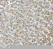 IHC staining of FFPE human liver tissue with PILT antibody, HRP-secondary and DAB substrate. HIER: boil tissue sections in pH8 EDTA for 20 min and allow to cool before testing.