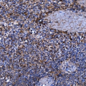 IHC staining of FFPE human spleen tissue with Septin 11 antibody. HIER: boil tissue sections in pH8 EDTA for 20 min and allow to cool before testing.