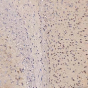 IHC staining of FFPE mouse brain tissue with Septin 11 antibody. HIER: boil tissue sections in pH8 EDTA for 20 min and allow to cool before testing.
