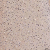 IHC staining of FFPE rat brain tissue with Septin 11 antibody. HIER: boil tissue sections in pH8 EDTA for 20 min and allow to cool before testing.