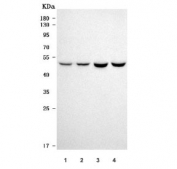 Western blot testing of 1) human HeLa, 2) human 293T, 3) rat brain and 4) mouse brain tissue lysate with Septin 11 antibody. Predicted molecular weight ~49 kDa.
