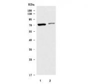 Western blot testing of huma 1) U-251 and 2) A431 cell lysate with TM9SF3 antibody. Predicted molecular weight ~68 kDa.