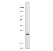 Western blot testing of human MCF7 cell lysate with TMEM88 antibody. Predicted molecular weight ~17 kDa.