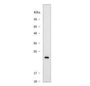 Western blot testing of human MCF7 cell lysate with TMEM88 antibody. Predicted molecular weight ~17 kDa.