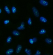 Immunofluorescent staining of FFPE human A549 cells with TOX2 antibody (green) and DAPI nuclear stain (blue). HIER: steam section in pH6 citrate buffer for 20 min.