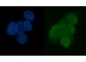 Immunofluorescent staining of FFPE human U-2 OS cells with TRMT6 antibody (green) and DAPI nuclear stain (blue). HIER: steam section in pH6 citrate buffer for 20 min.