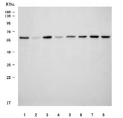 Western blot testing of human 1) HepG2, 2) placenta, 3) Daudi, 4) A431, 5) U-251, 6) SH-SY5Y, 7) MOLT4 and 8) HEL cell lysate with TRMT6 antibody. Predicted molecular weight ~56 kDa.