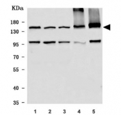 Western blot testing of 1) human Daudi, 2) human MOLT4, 3) human HEL, 4) rat brain and 5) mouse brain tissue lysate with WDR7 antibody. Predicted molecular weight ~164 kDa.