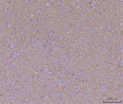 IHC staining of FFPE rat brain tissue with WDR7 antibody. HIER: boil tissue sections in pH8 EDTA for 20 min and allow to cool before testing.